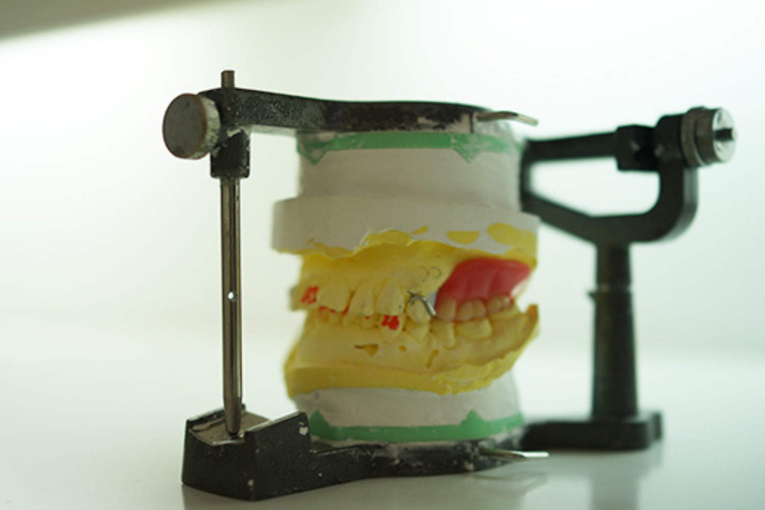 口腔外科・噛み合わせ治療