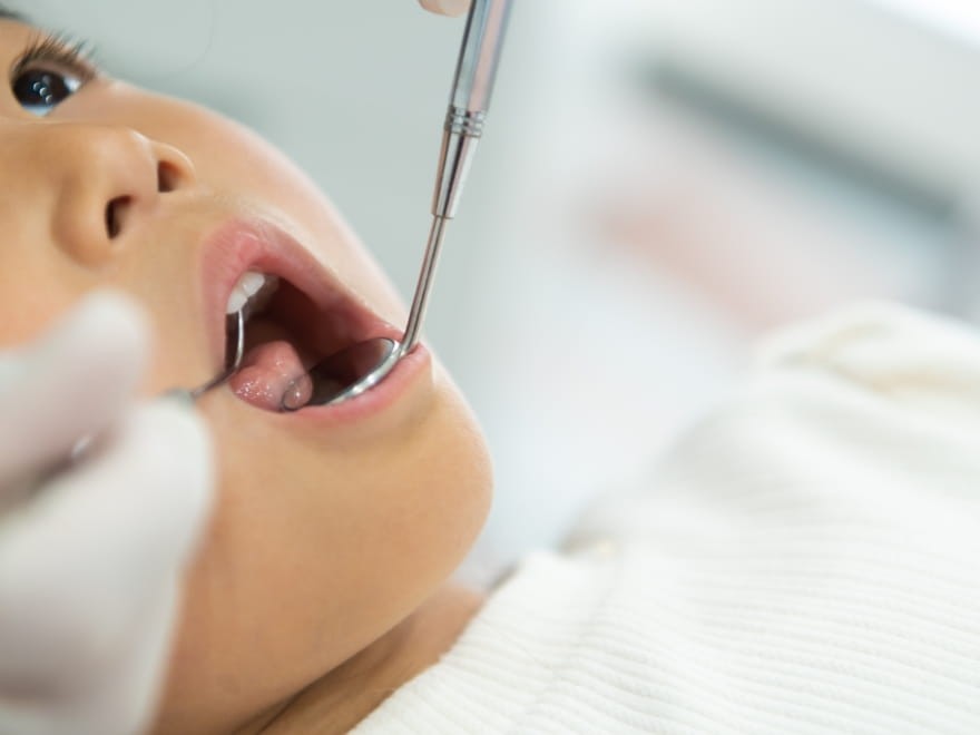 虫歯治療だけにとどまらず、フッ素塗布や定期検診を通じて、お子様の成長段階に合わせた予防ケアを行っています