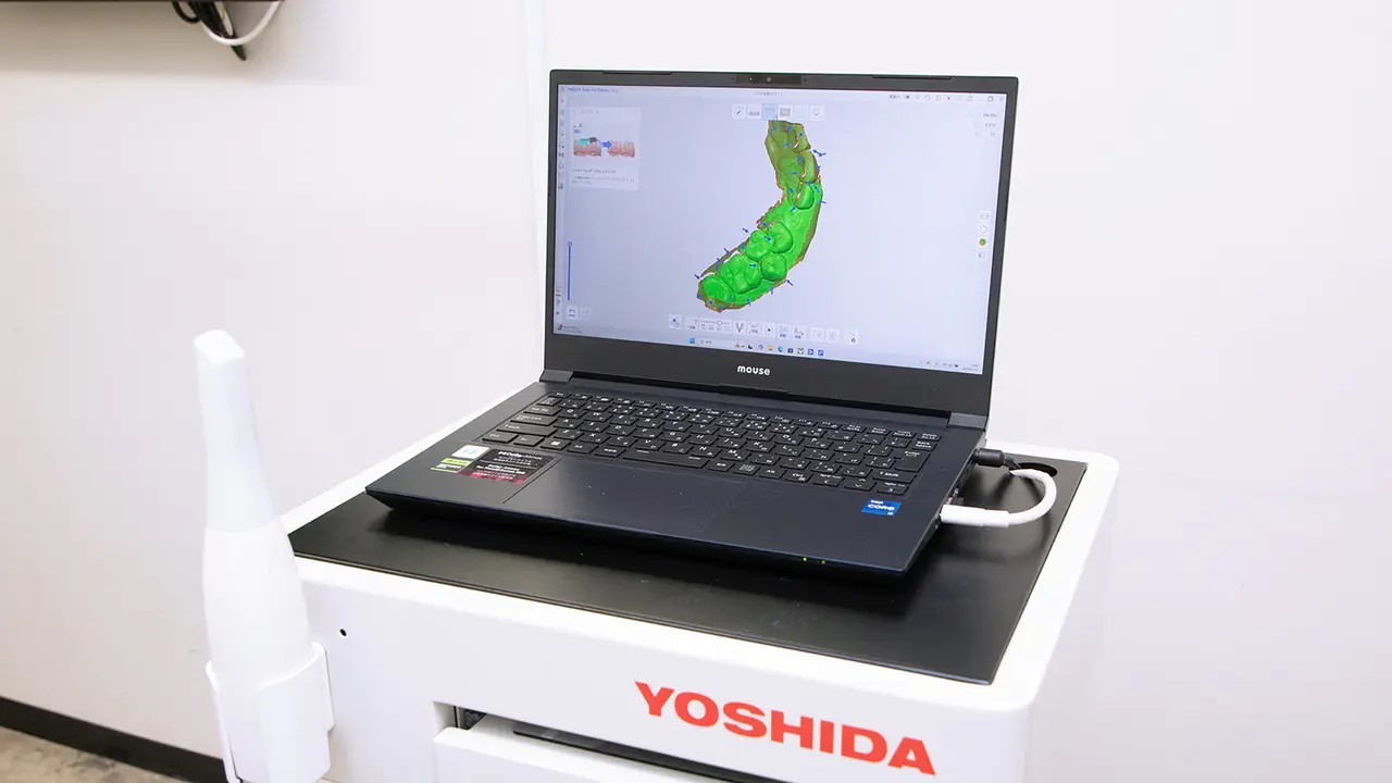 お口の型どりに使用する3D光学デジタルスキャナーです