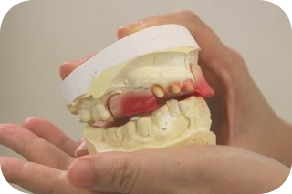 快適な入れ歯をご用意いたします