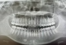 【伊東駅から徒歩5分】笑気麻酔対応で安心できるちゃいるど歯科医院