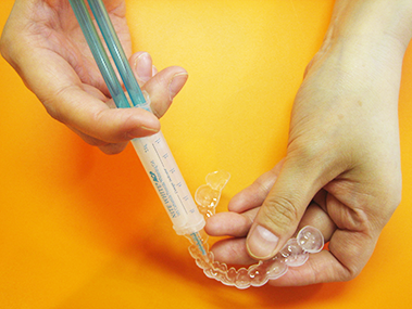 ①②ホワイトニング：ご自宅で薬剤を塗布して使用するシステムです ③インプラント：レントゲン・口腔内写真