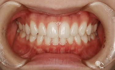 患者さん一人一人に合わせた最適な治療を提供します