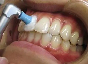 定期的なメンテナンスを受けましょう