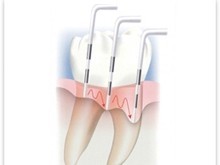 歯周病に対し、科学的な根拠に基づいた精密な治療を実践しています