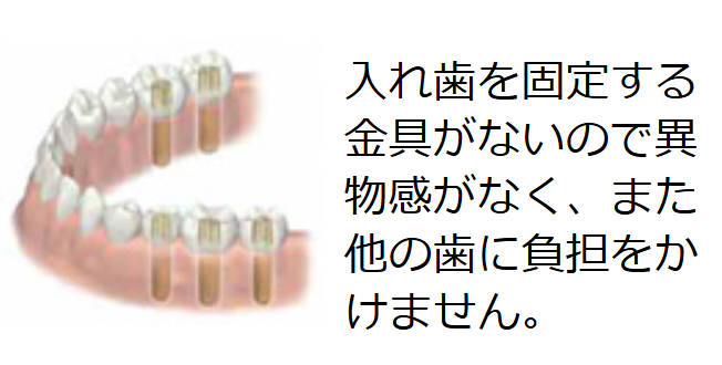 お口の健康を守り、日常生活の楽しさを取り戻すために、ぜひご相談ください。