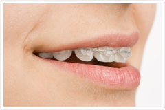 専用の装置で歯並びを改善します