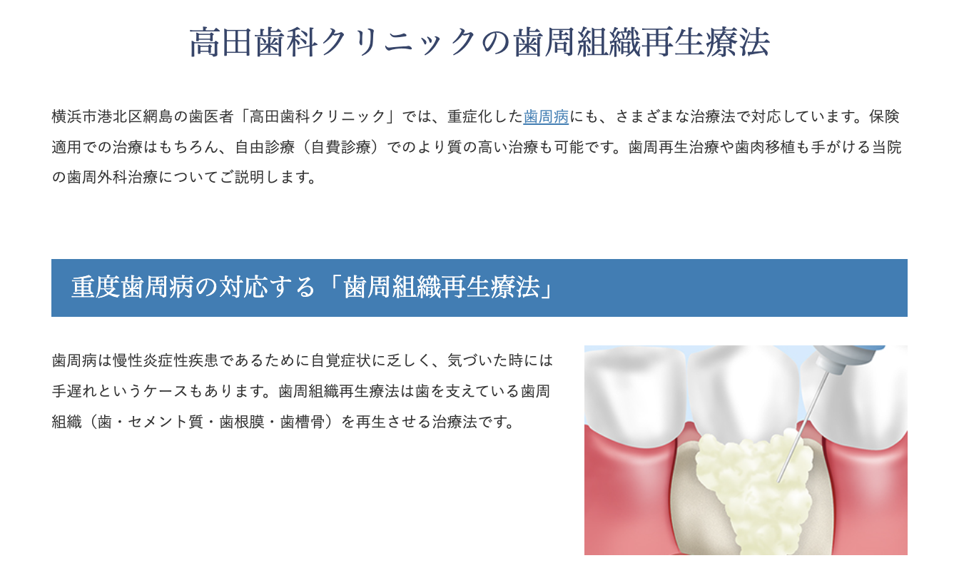 歯周病により損なわれた歯周組織を回復させるために、歯周組織再生療法を行っています