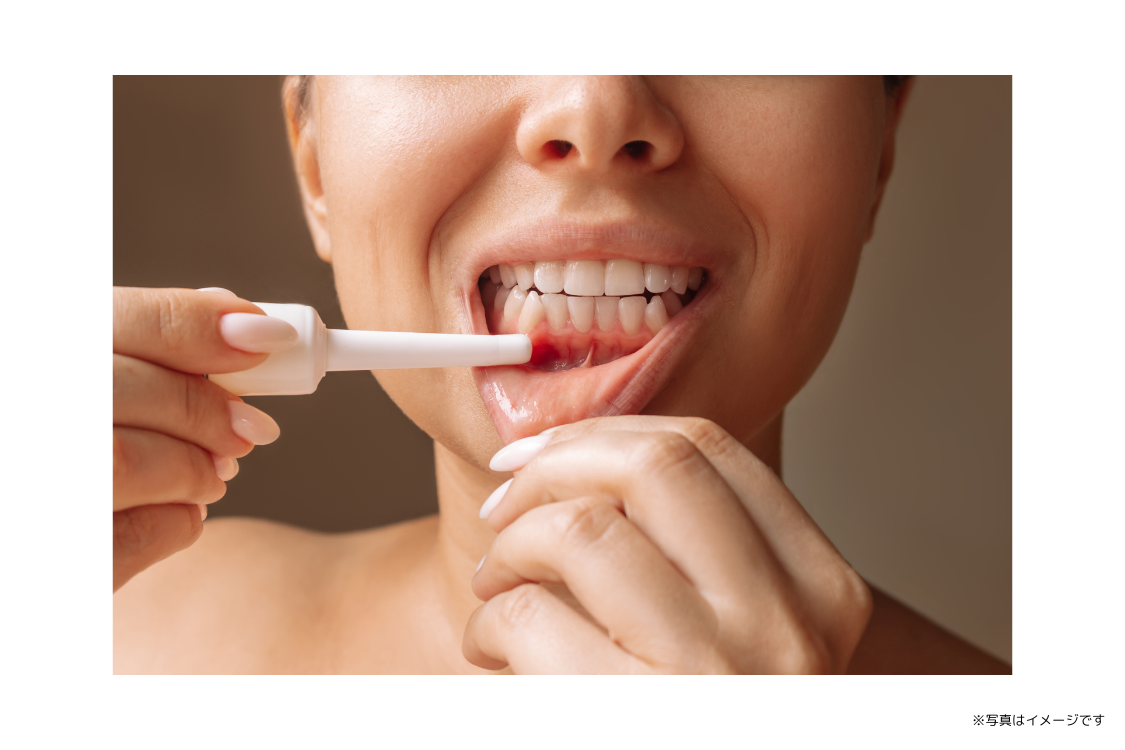 歯を失う大きな原因となる歯周病に対し、早期発見と継続的なケアによる対応が行われています