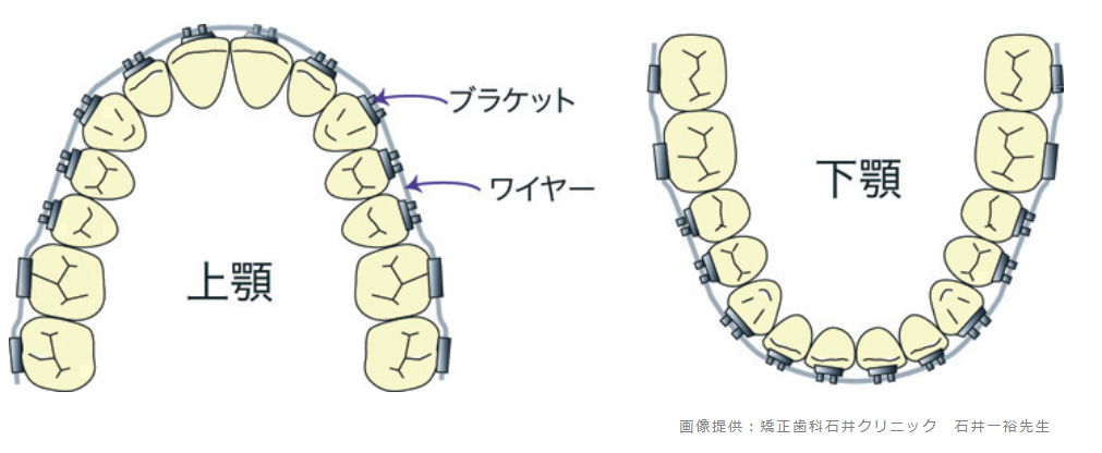 患者様おひとりおひとりに合わせて、オーダーメイドの矯正治療をおこないます。