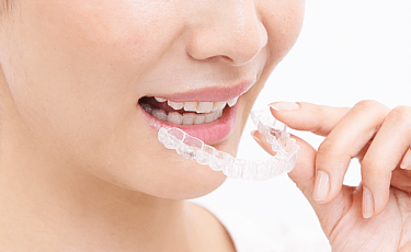 取り外しができる矯正装置