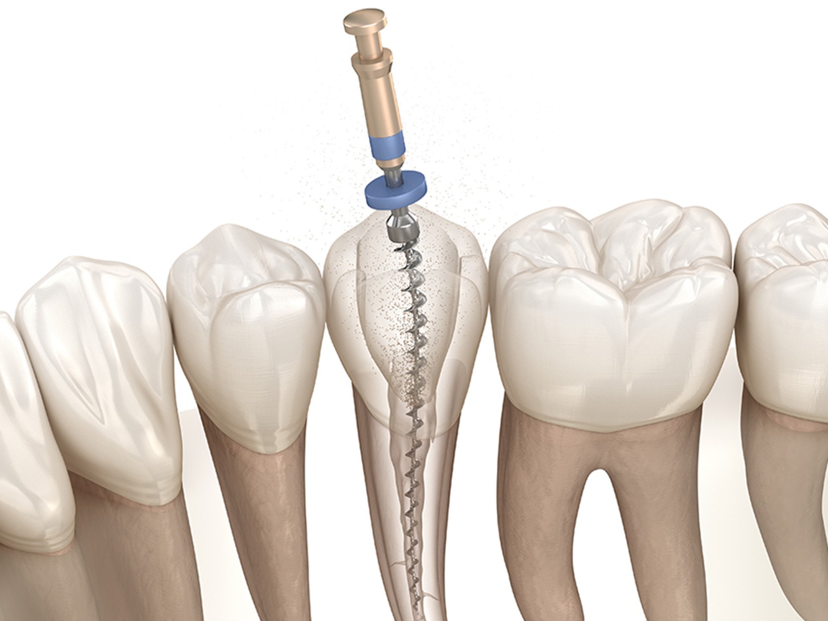 精密な診断をして治療します