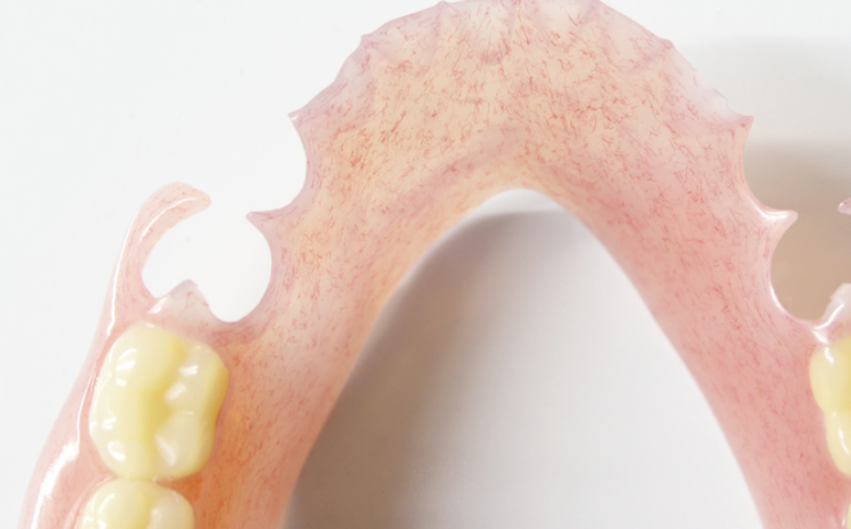 個々の状況に合わせた入れ歯選択で快適な装着感と機能性を実現