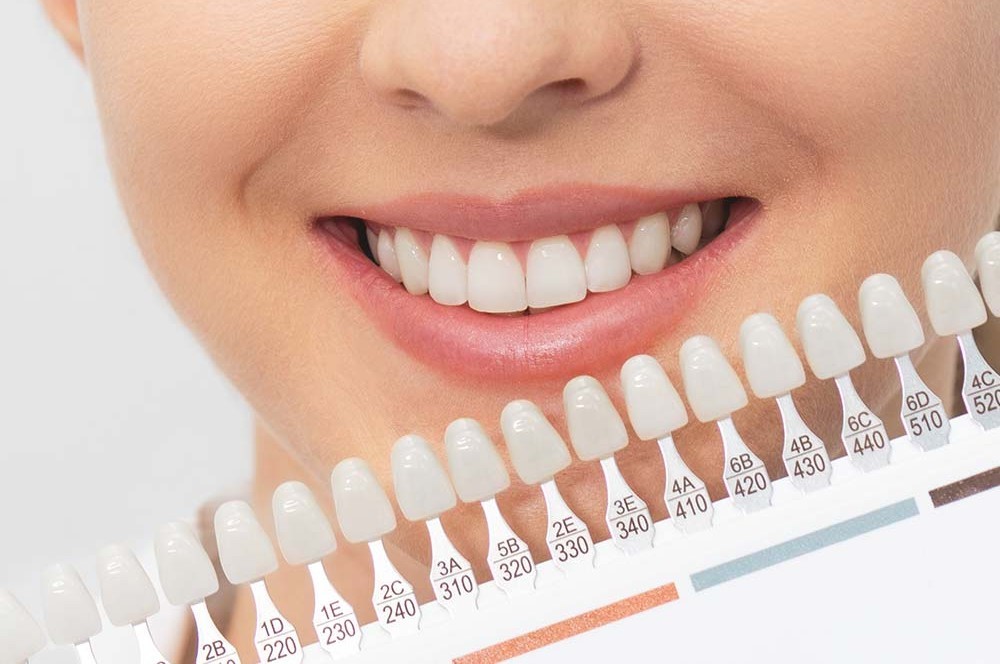 自分に合ったホワイトニング方法について相談することが可能です