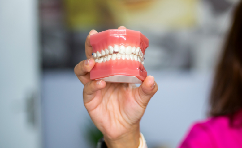 目立たない矯正で理想の口元を実現