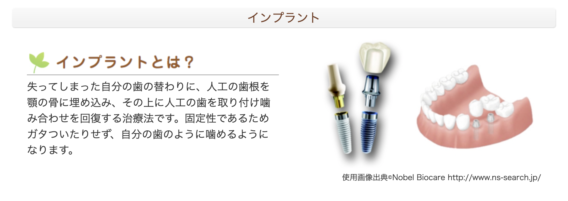 歯を失った方に対して快適な噛み心地を提供するインプラント治療を行っています