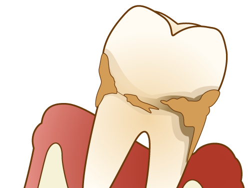 写真はイメージです