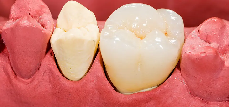 最新スキャナーで高精度な型取りを短時間で実現します