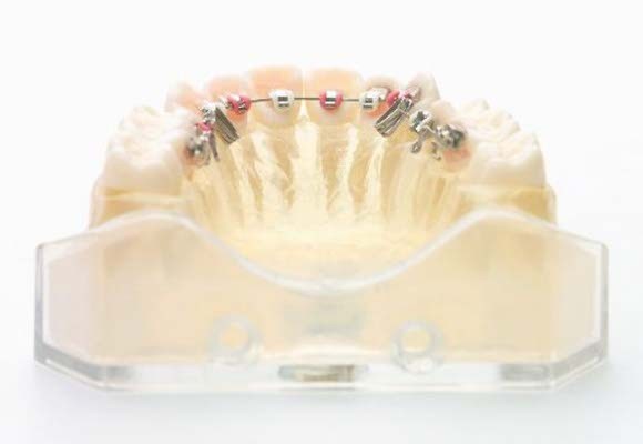 最適な治療方法を提案することで、自然で美しい歯並びへと導く矯正治療を実現しています。