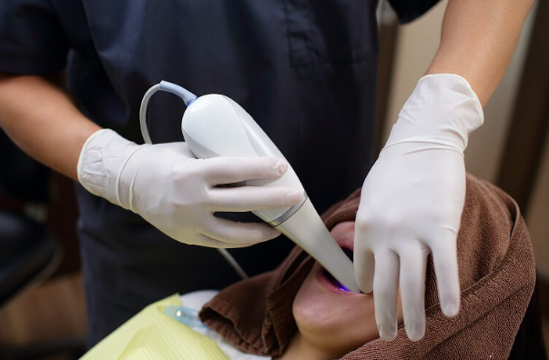 3D光学印象スキャナー