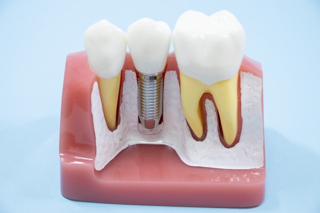 写真はイメージです