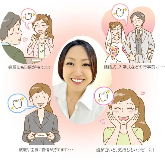 理想の白い歯に