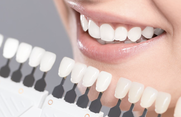 ご希望の白さやライフスタイルに合わせた治療プランをご提案します