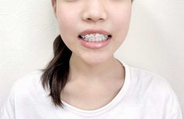 患者様一人ひとりの歯並びや噛み合わせを確認し、それぞれのお悩みや希望に合わせた治療方法を提案しています。※写真はイメージです。