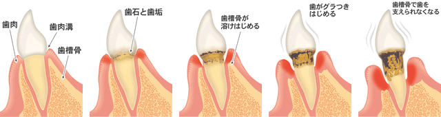 日本歯周病学会元理事長をお招きしての治療を行います