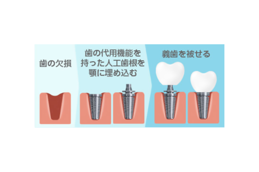 定期的なメンテナンスで健康な状態に保ちます