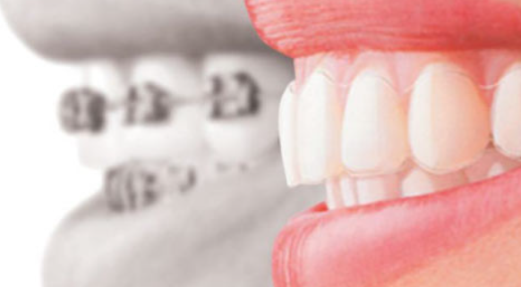 歯並びのお悩みをお聞かせください