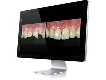 見た目と健康を両立させる矯正プランを提案