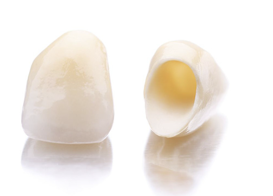 歯の機能性だけでなく見た目の美しさを追求する治療方法です