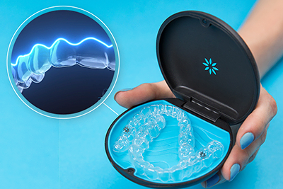 費用が抑えられるインビザラインGo