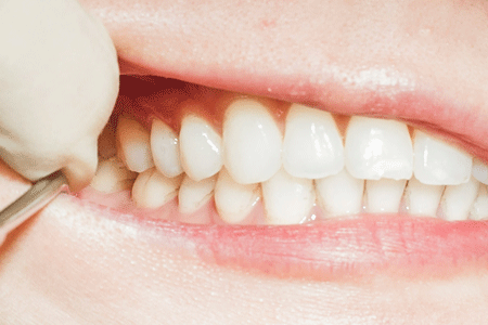 保険適用外のものの作製は専門医が行っております