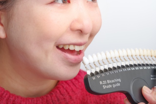 審美歯科を通して「健康だからこそ美しい口元」を実現することを目標にしています。※写真はイメージです。