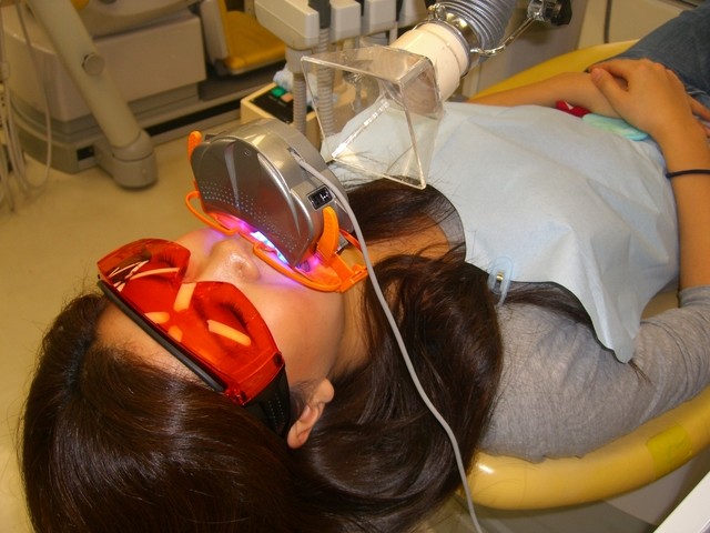 オフィスホワイトニングの様子