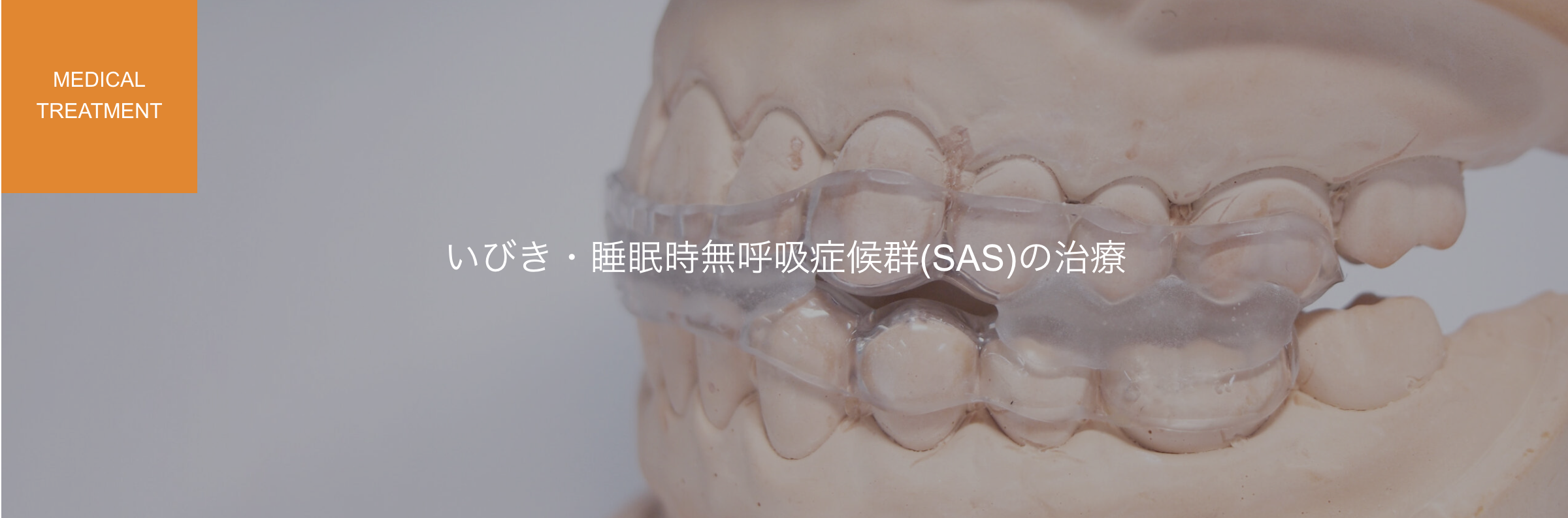 いびきや睡眠時無呼吸症候群（SAS）の治療として、身体に優しいマウスピース治療を提供しています