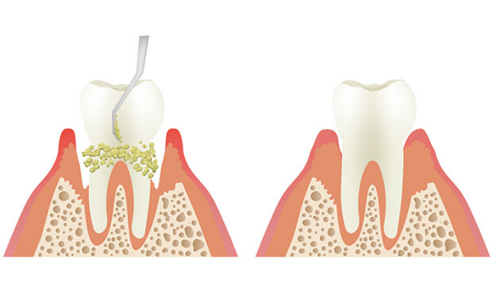 定期的に、お口のメンテナンスを兼ねた歯科検診をおすすめします。