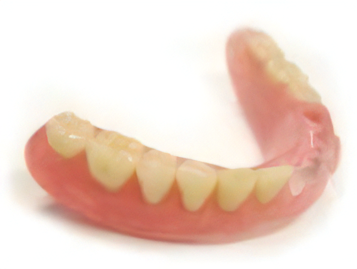 スマイルデンチャーで笑顔に自信を