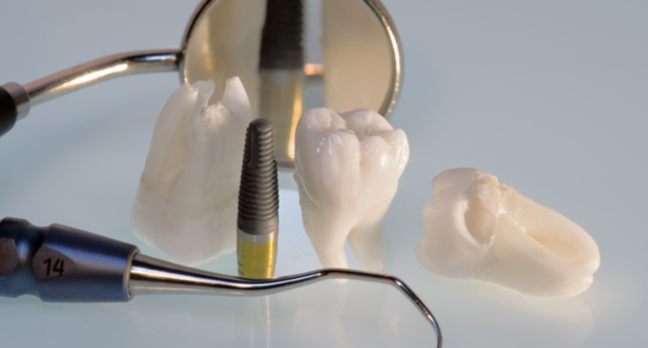 見た目や機能が非常に自然に仕上がります。