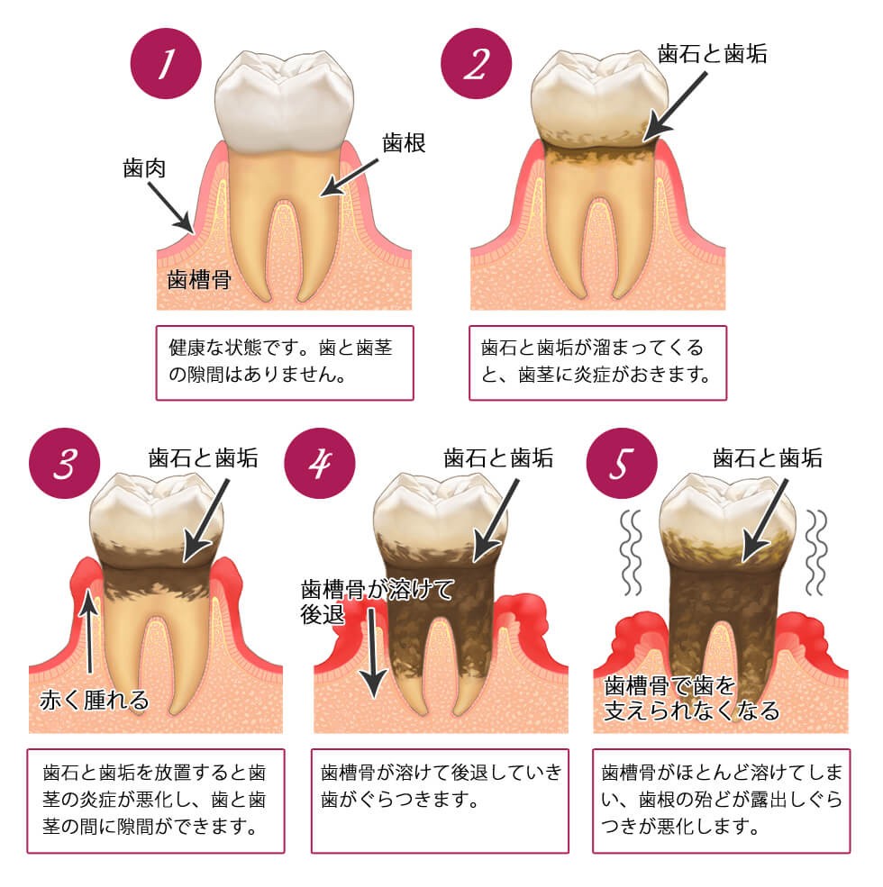 検査とケアを重ね再発を防いでいます